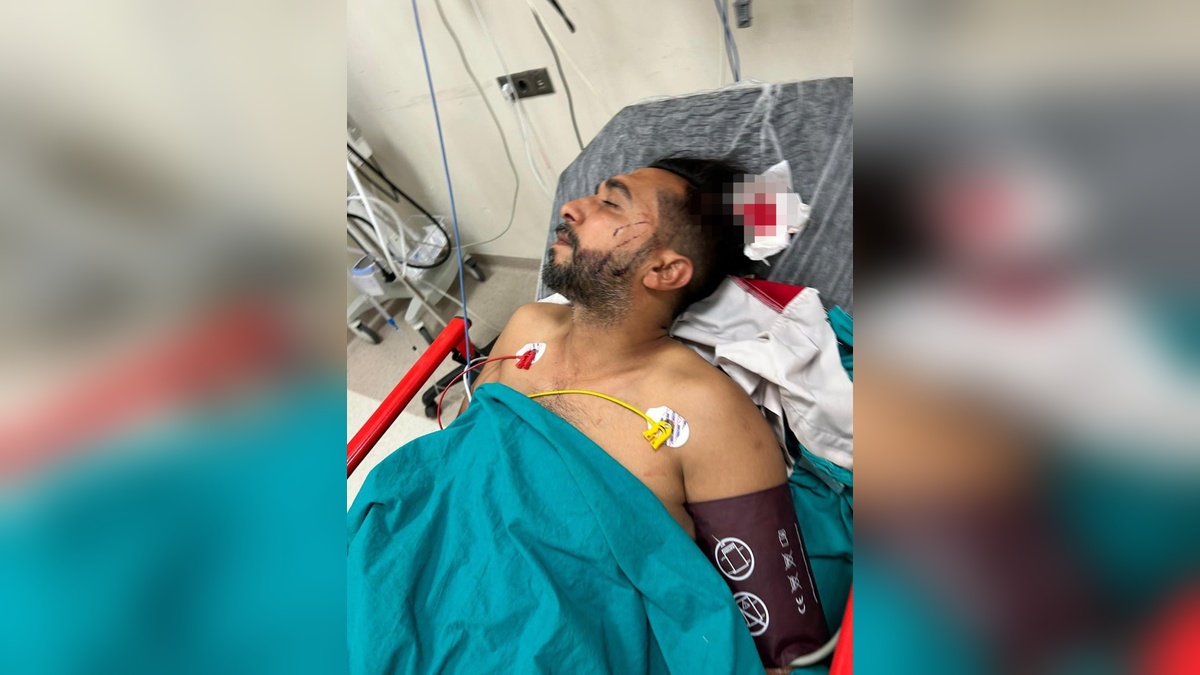 Adana'da döner yerken başından vurulan Ahmet Malgir'in hayati tehlikesi sürüyor