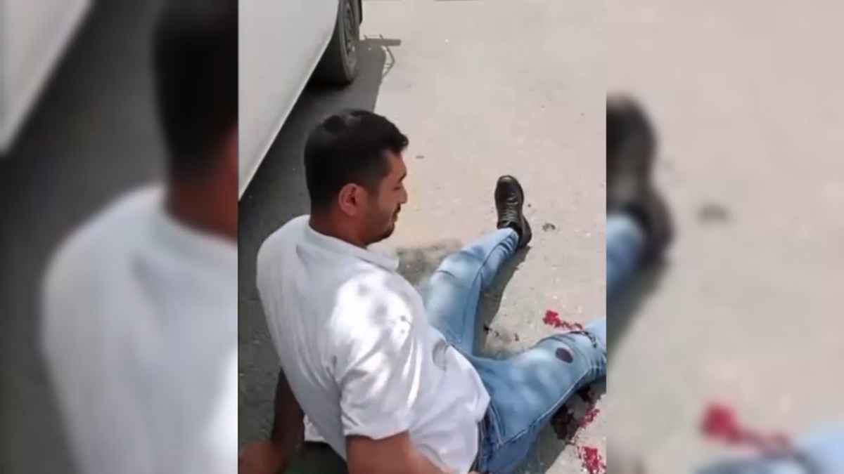 Malatya'da tartışma: Kadın, rahatsız eden kişiyi vurdu