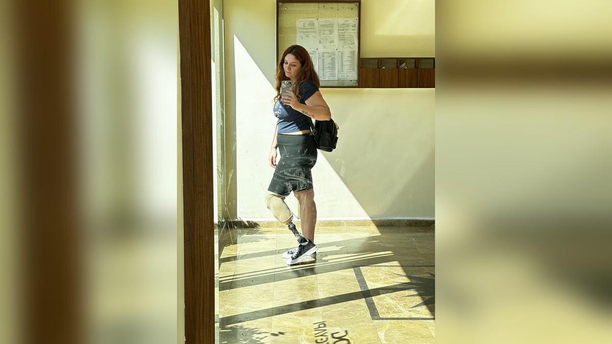 Gizem Başaran: Protez bacağıyla yeniden motosiklet sürüyor