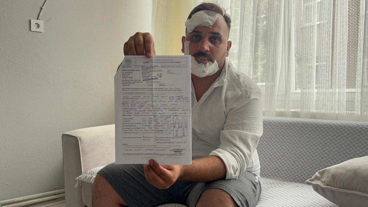 Dilovası'nda taksi şoförü polisler tarafından dövüldü: 'Sülalenizi öldürürüz' tehdidi