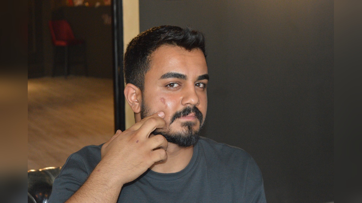 Mardin'de lazer epilasyonda yanık: Suç duyurusu