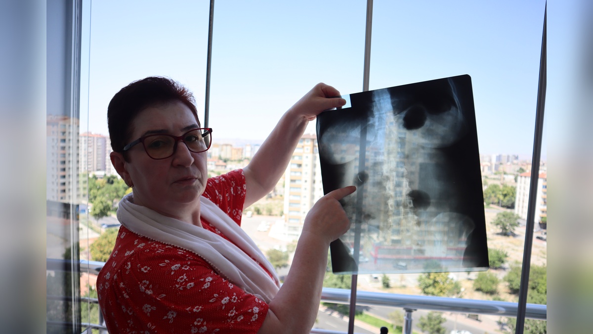 Kayseri'de 22 yıldır karnında iğneyle yaşayan Ayhan Tanyıldız: 'Yaşayan ölü gibiyim'