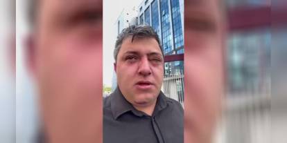 Altındağ Belediye Başkanı Tiryaki, Personelini Darp Etmekle Suçlanıyor
