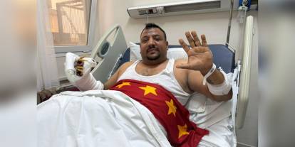 Galatasaraylı Kadir Ircı'nın iş kazası: Osimhen'e çağrı
