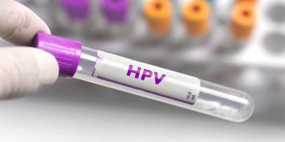 HPV Hastalığı: Belirtileri, Tedavisi ve Önemi