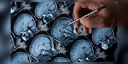 Harvard çalışması: Beyindeki lityum seviyesi Alzheimer'ı etkiliyor